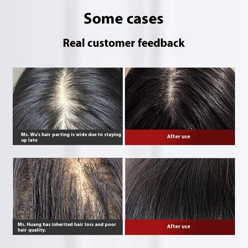 Rubbing Hair Comb Scalp Electric Massage Comb Red Light Anti-density Hair Growth Device